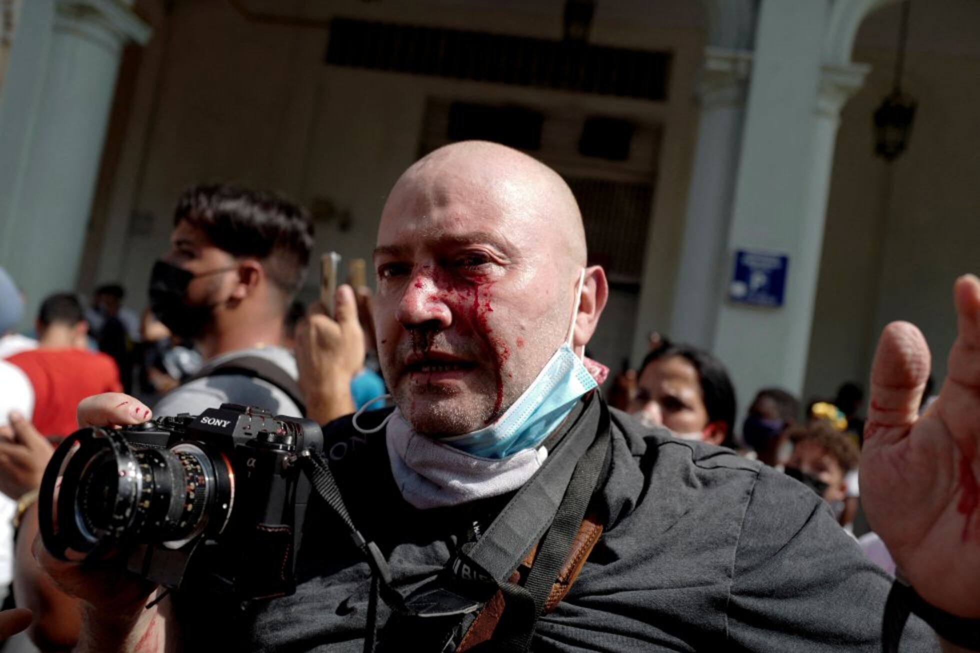 fotografo-herido-protestas-Cuba